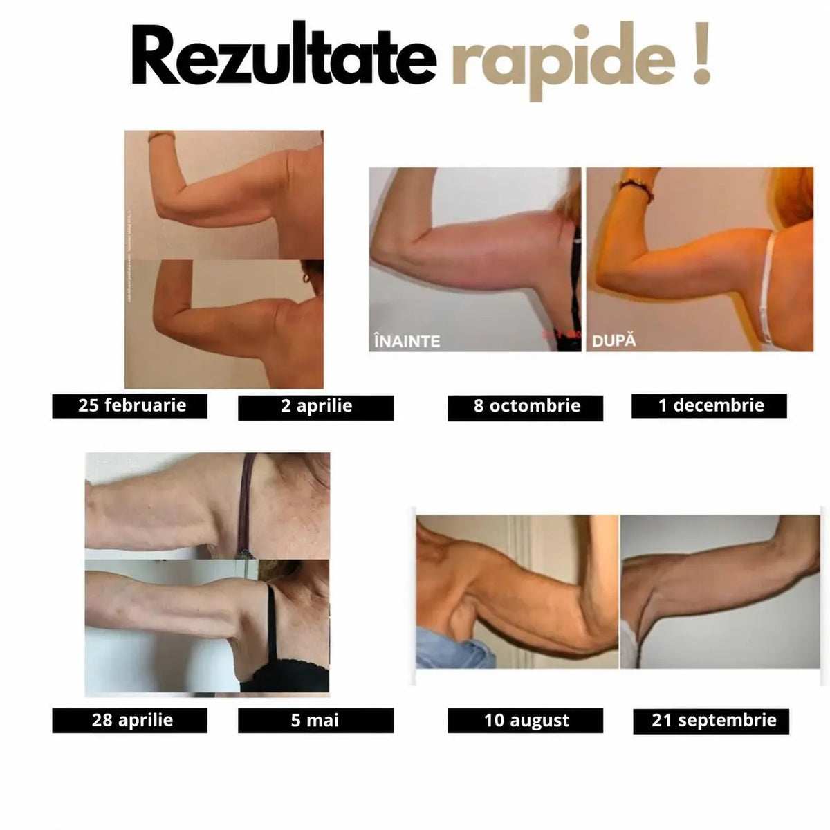 Manșoane modelatoare ANAE – Susținere și confort